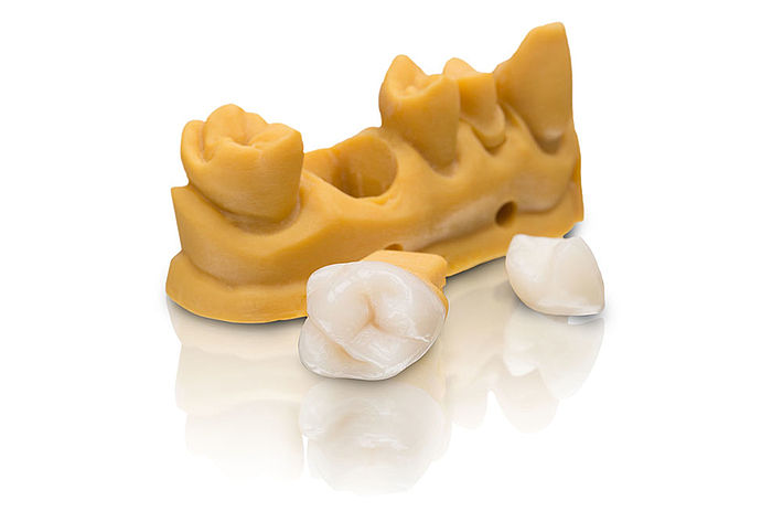 csm_std_bild_1K_VarseoSmile-Crown_ec1fb07147